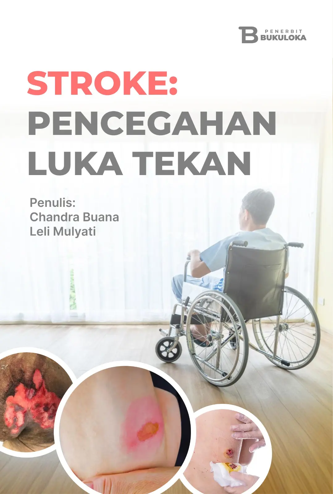 Stroke: Pencegahan Luka Tekan