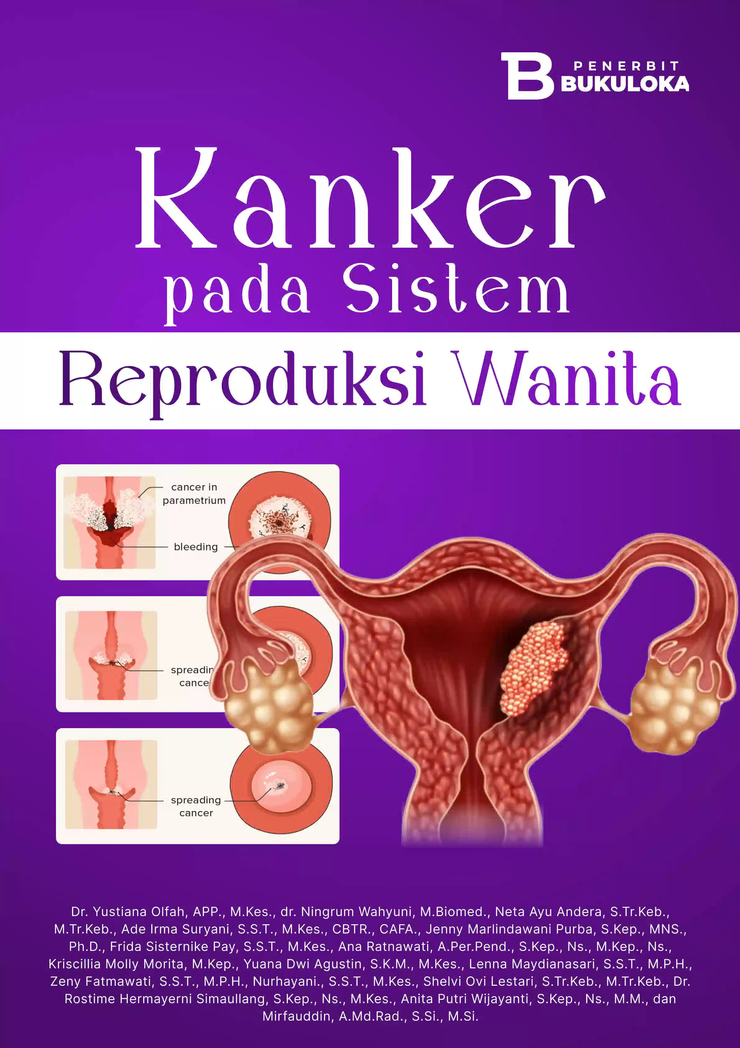 Kanker Pada Sistem Reproduksi Wanita